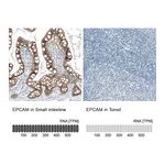 Atlas Antibodies Anti-EPCAM Antibody