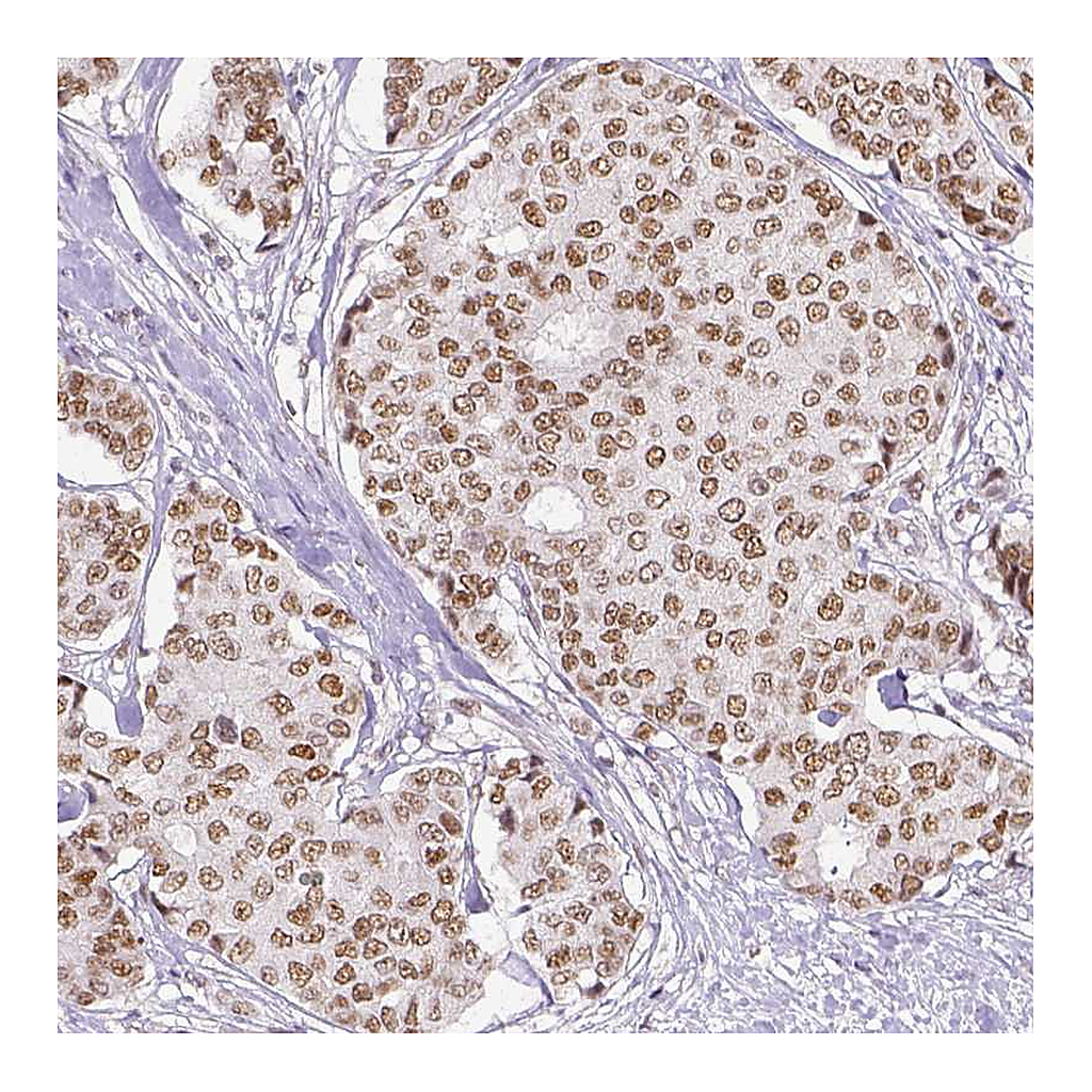 Atlas Antibodies Anti-ERCC1 Antibody