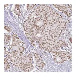 Atlas Antibodies Anti-ERCC1 Antibody