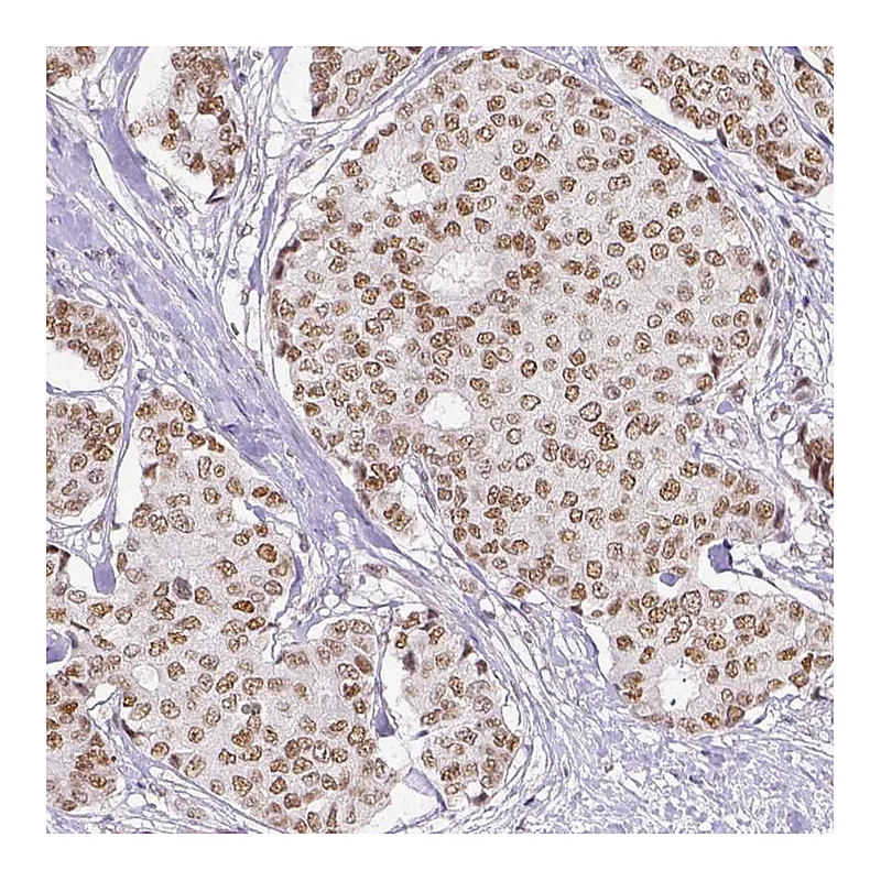Atlas Antibodies Anti-ERCC1 Antibody