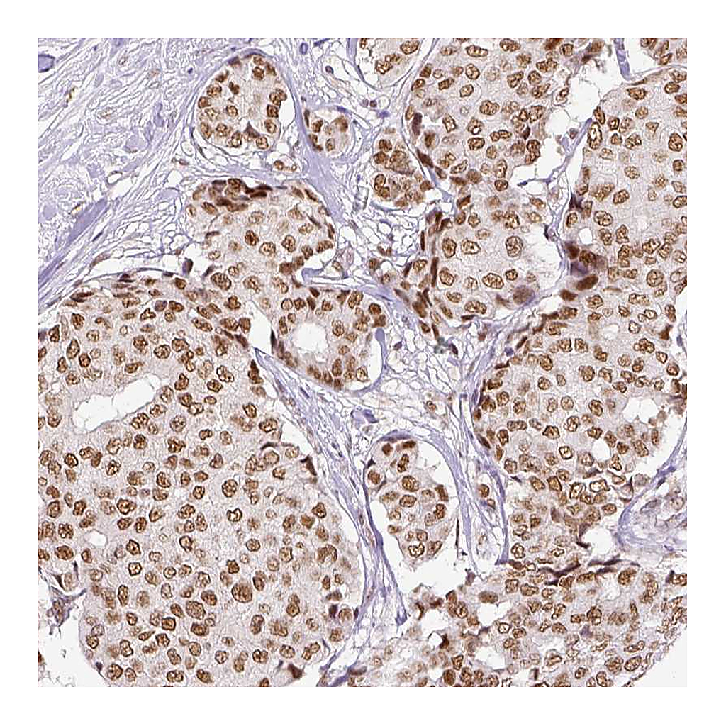 Atlas Antibodies Anti-ERCC1 Antibody