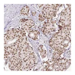 Atlas Antibodies Anti-ERCC1 Antibody