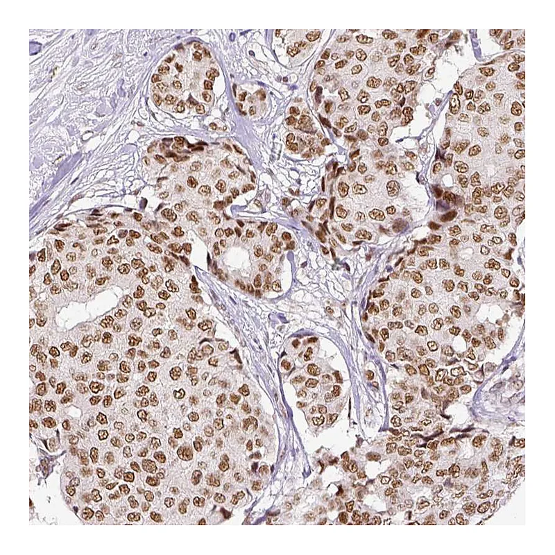 Atlas Antibodies Anti-ERCC1 Antibody