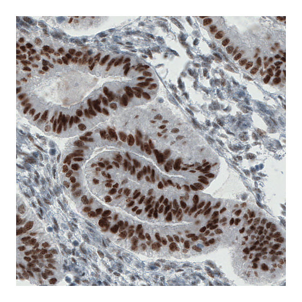 Atlas Antibodies Anti-ESR1 Antibody