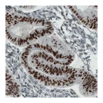 Atlas Antibodies Anti-ESR1 Antibody