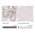 Atlas Antibodies Anti-EZH2 Antibody