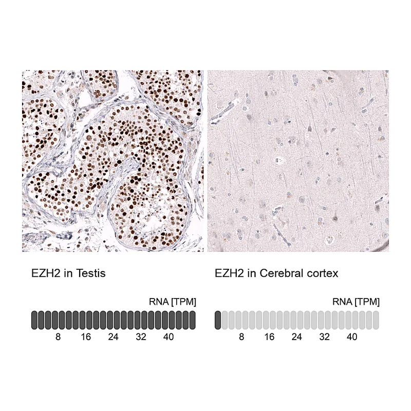 Atlas Antibodies Anti-EZH2 Antibody