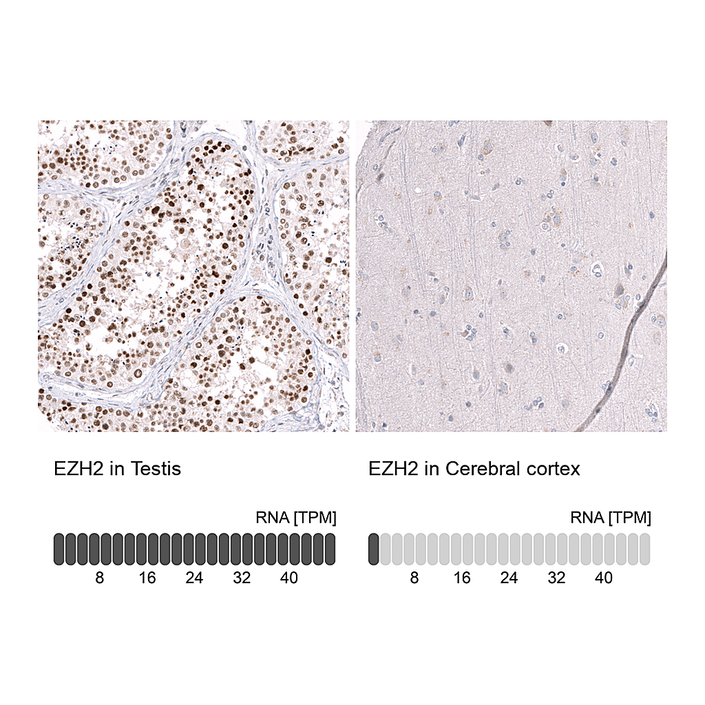 Atlas Antibodies Anti-EZH2 Antibody