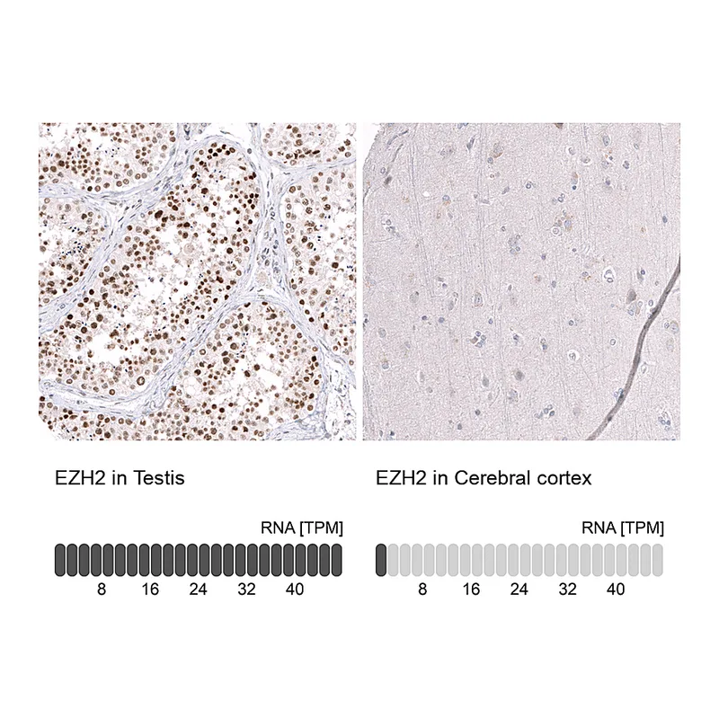 Atlas Antibodies Anti-EZH2 Antibody