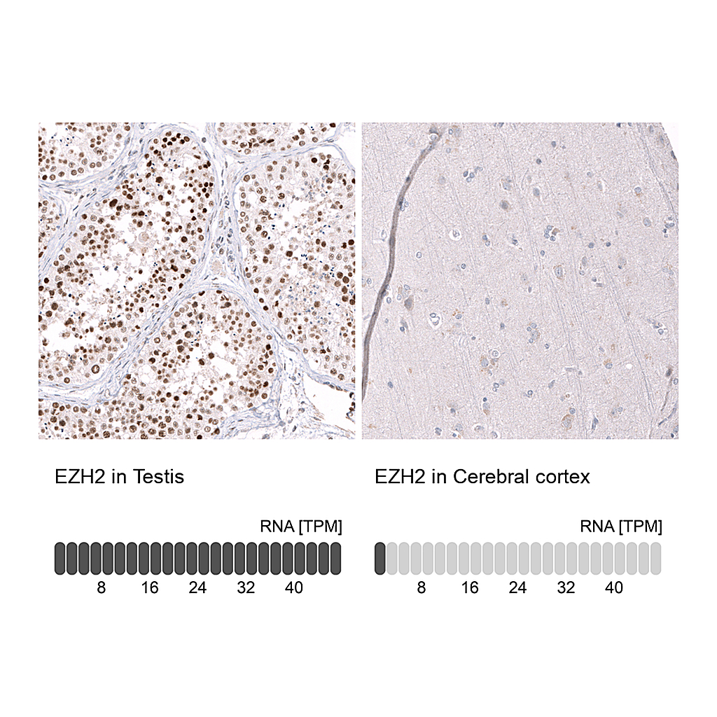 Atlas Antibodies Anti-EZH2 Antibody