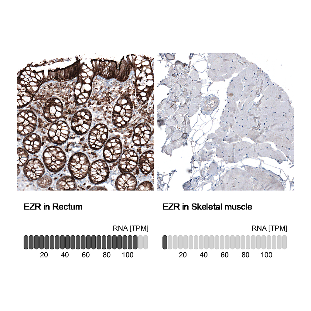 Atlas Antibodies Anti-EZR Antibody