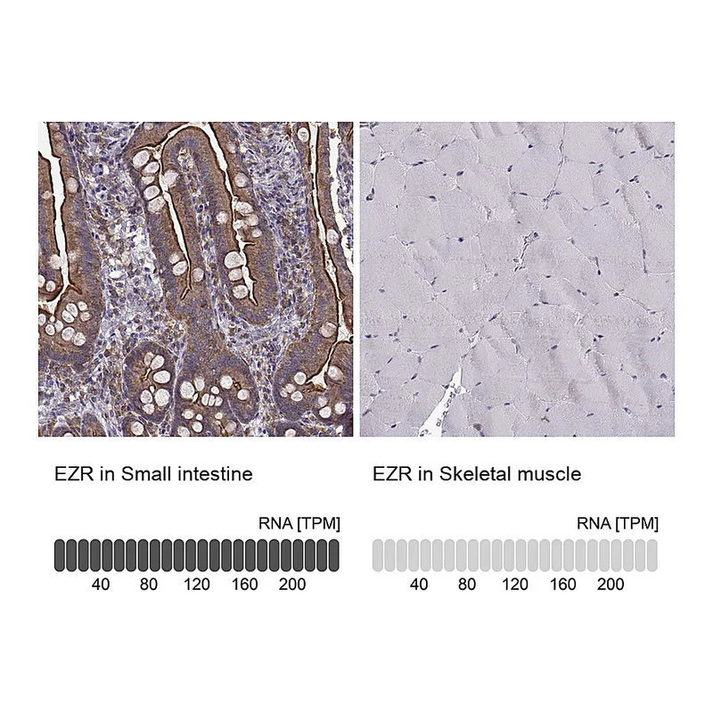 Atlas Antibodies Anti-EZR Antibody