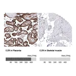 Atlas Antibodies Anti-EZR Antibody