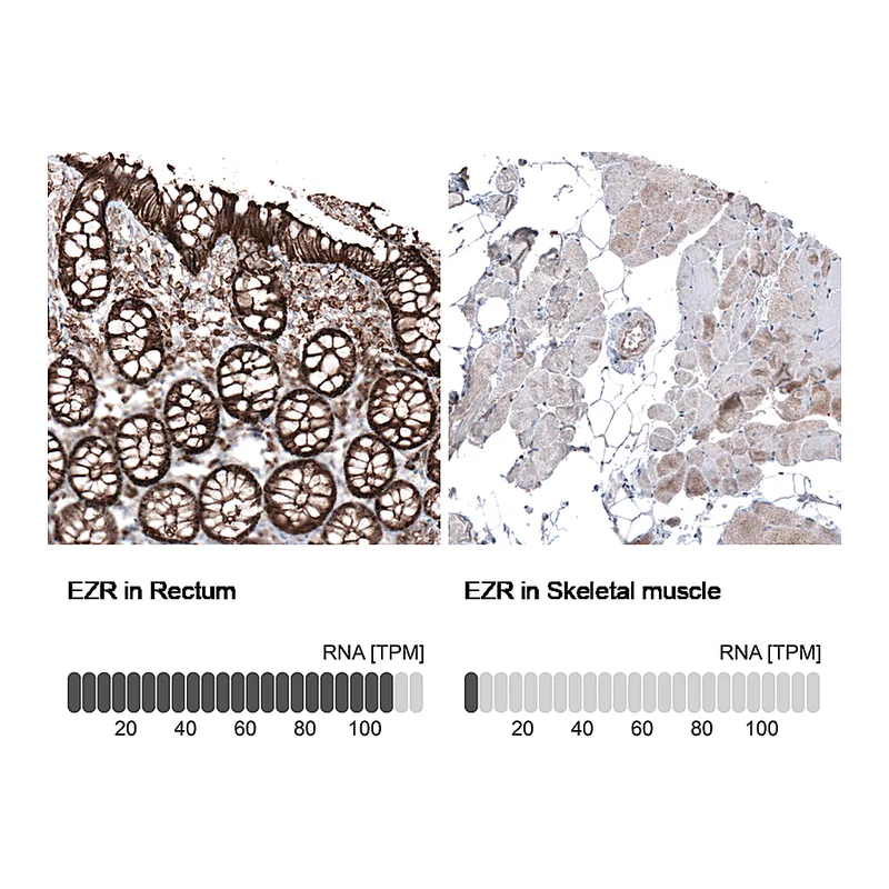Atlas Antibodies Anti-EZR Antibody