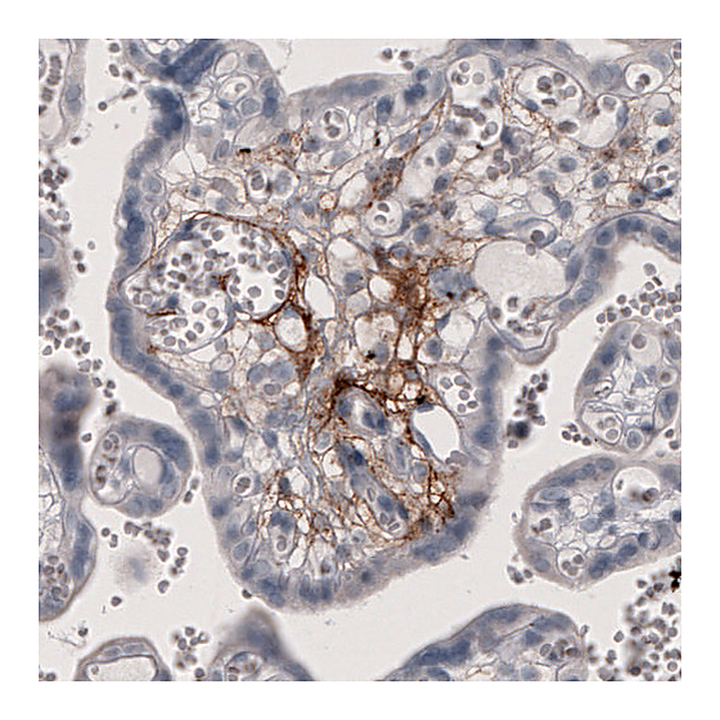 Atlas Antibodies Anti-F3 Antibody