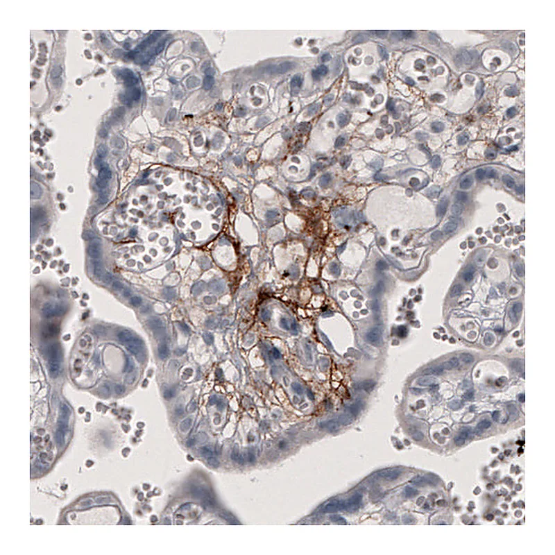 Atlas Antibodies Anti-F3 Antibody