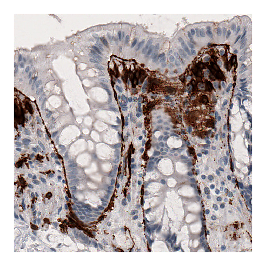 Atlas Antibodies Anti-F3 Antibody