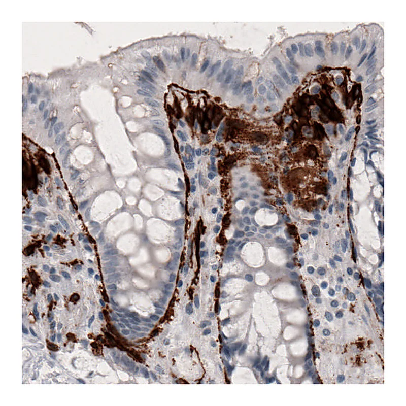Atlas Antibodies Anti-F3 Antibody