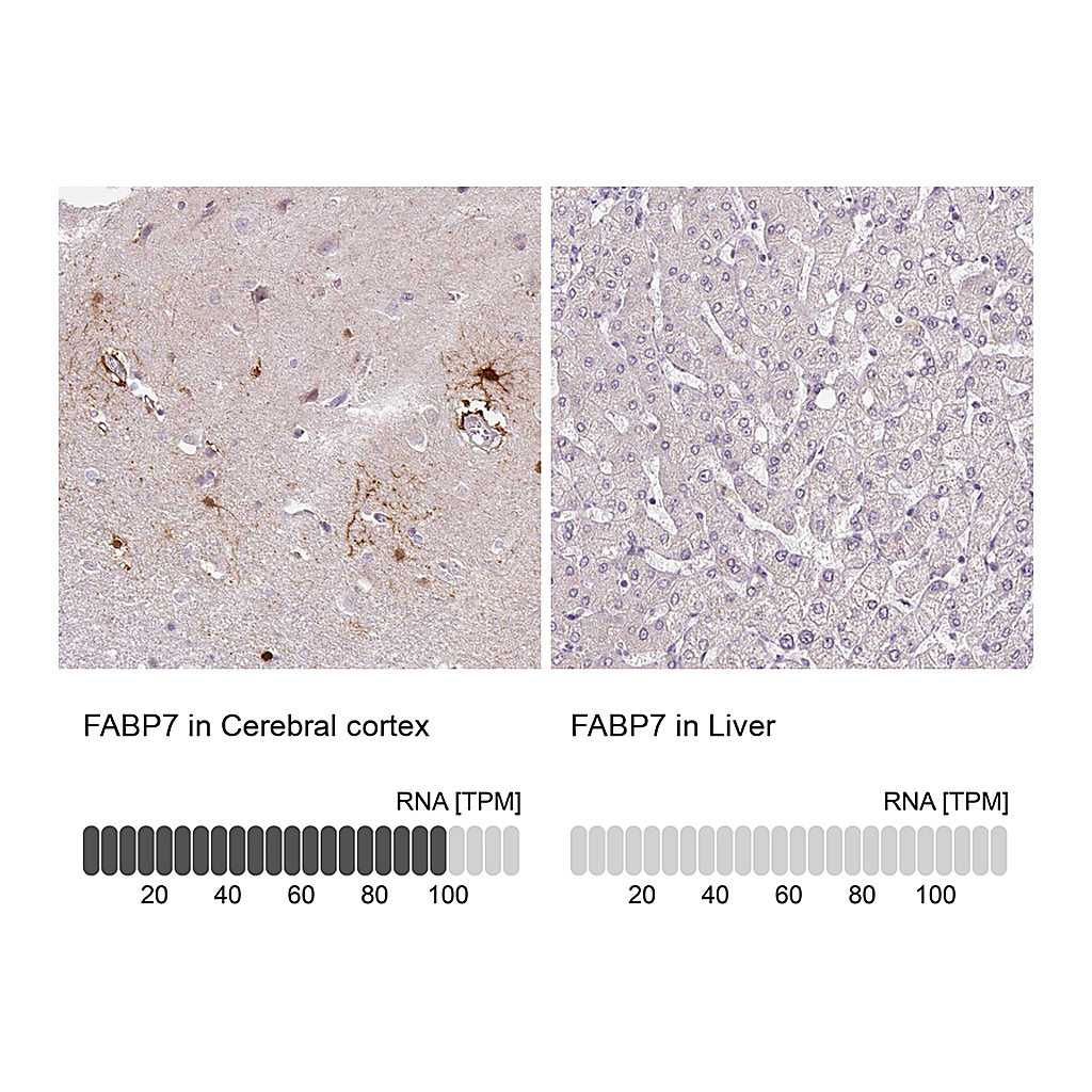 Atlas Antibodies Anti-FABP7 Antibody