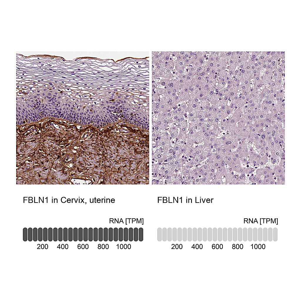 Atlas Antibodies Anti-FBLN1 Antibody