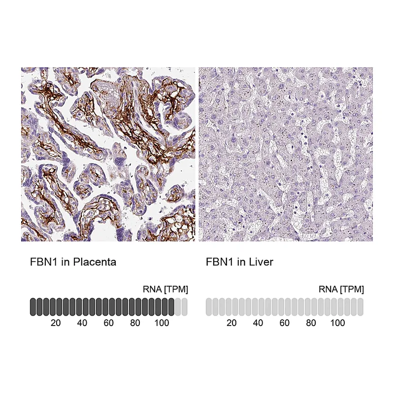 Atlas Antibodies Anti-FBN1 Antibody