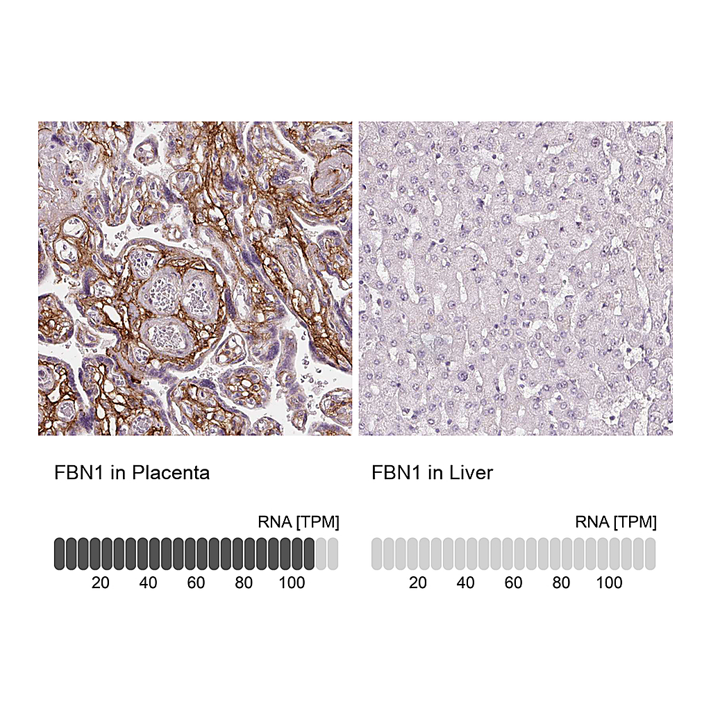 Atlas Antibodies Anti-FBN1 Antibody