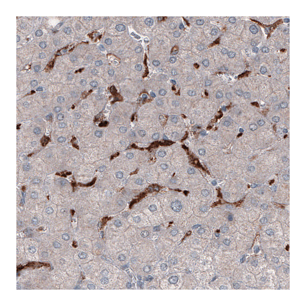 Atlas Antibodies Anti-FCGRT Antibody