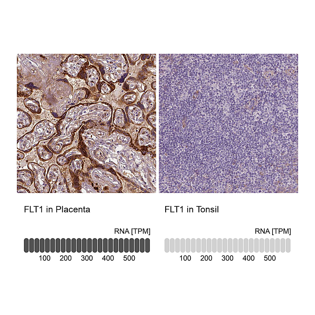 Atlas Antibodies Anti-FLT1 Antibody