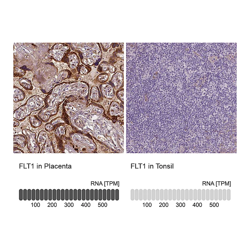 Atlas Antibodies Anti-FLT1 Antibody