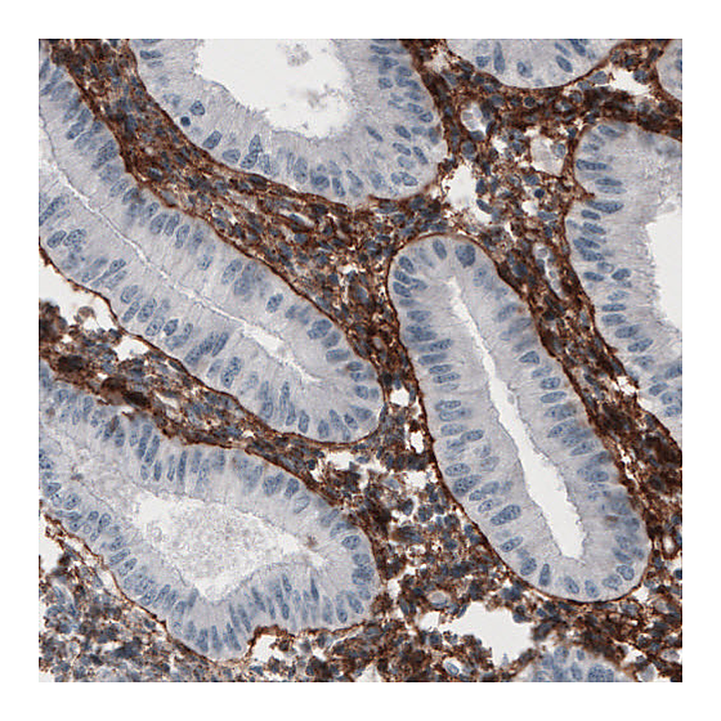 Atlas Antibodies Anti-FN1 Antibody