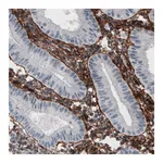 Atlas Antibodies Anti-FN1 Antibody