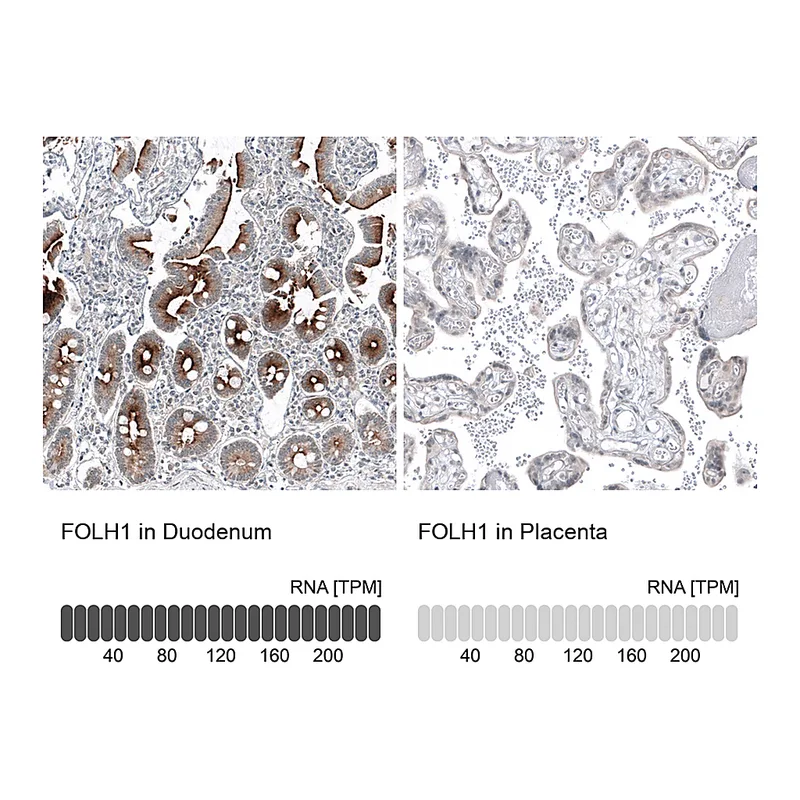Atlas Antibodies Anti-FOLH1 Antibody