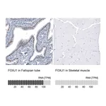 Atlas Antibodies Anti-FOXJ1 Antibody