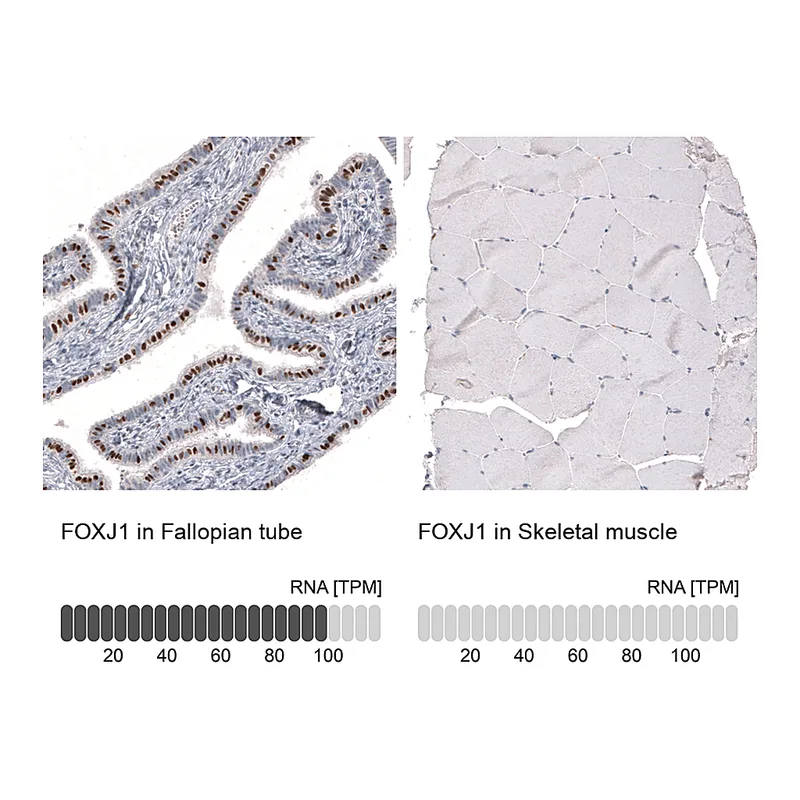 Atlas Antibodies Anti-FOXJ1 Antibody