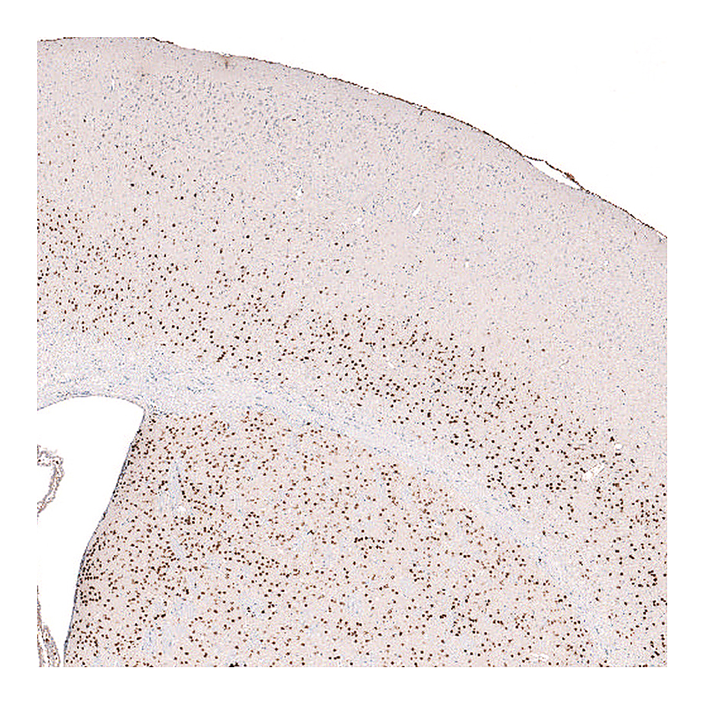 Atlas Antibodies Anti-FOXP2 Antibody