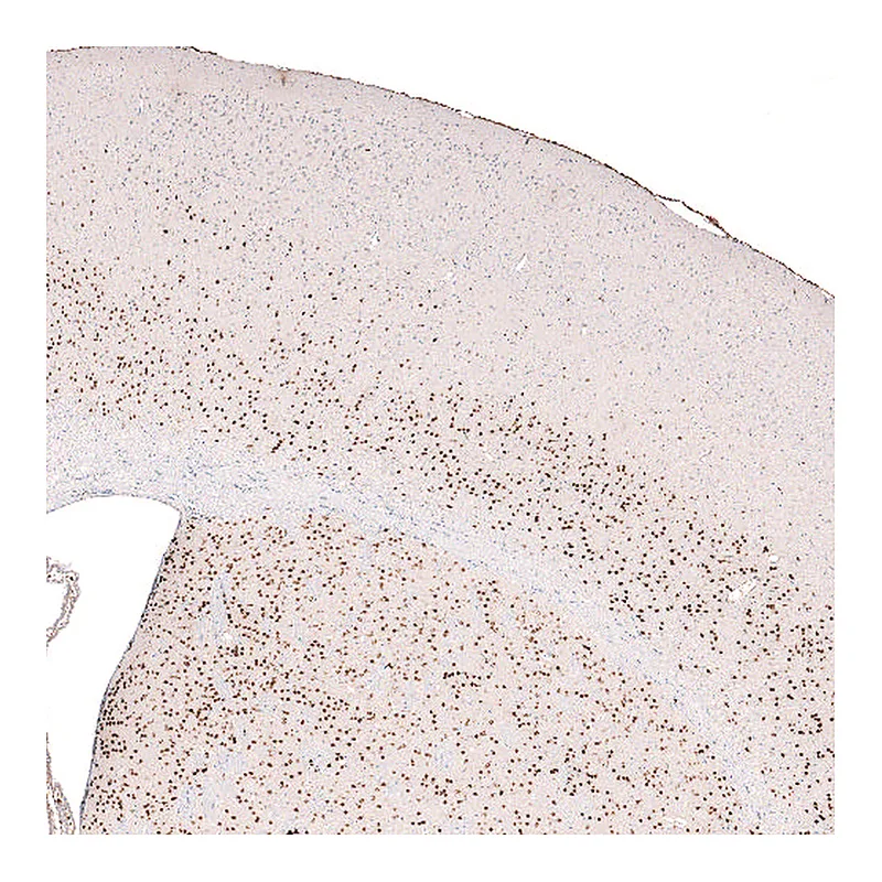 Atlas Antibodies Anti-FOXP2 Antibody