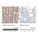 Atlas Antibodies Anti-FRMD5 Antibody