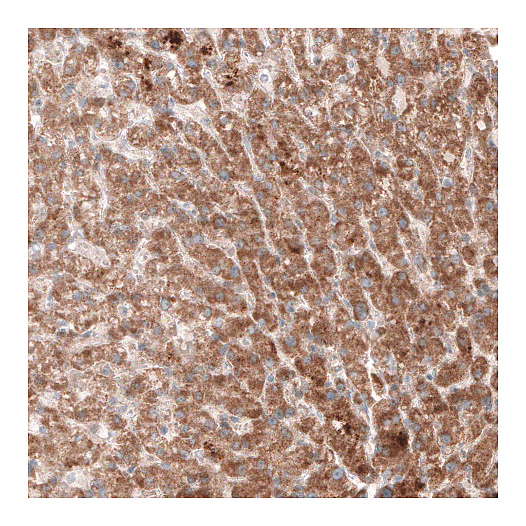 Atlas Antibodies Anti-G6PC Antibody