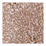 Atlas Antibodies Anti-G6PC Antibody