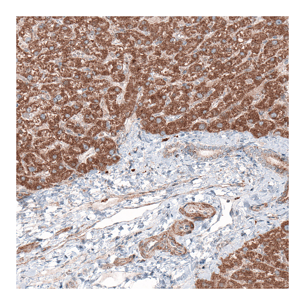 Atlas Antibodies Anti-G6PC Antibody