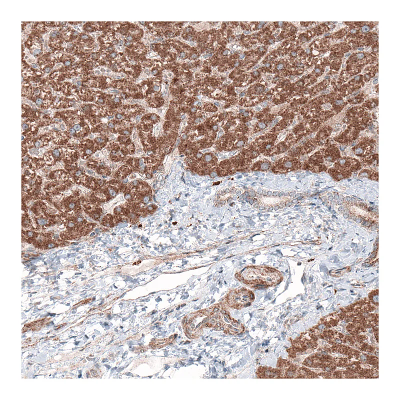 Atlas Antibodies Anti-G6PC Antibody