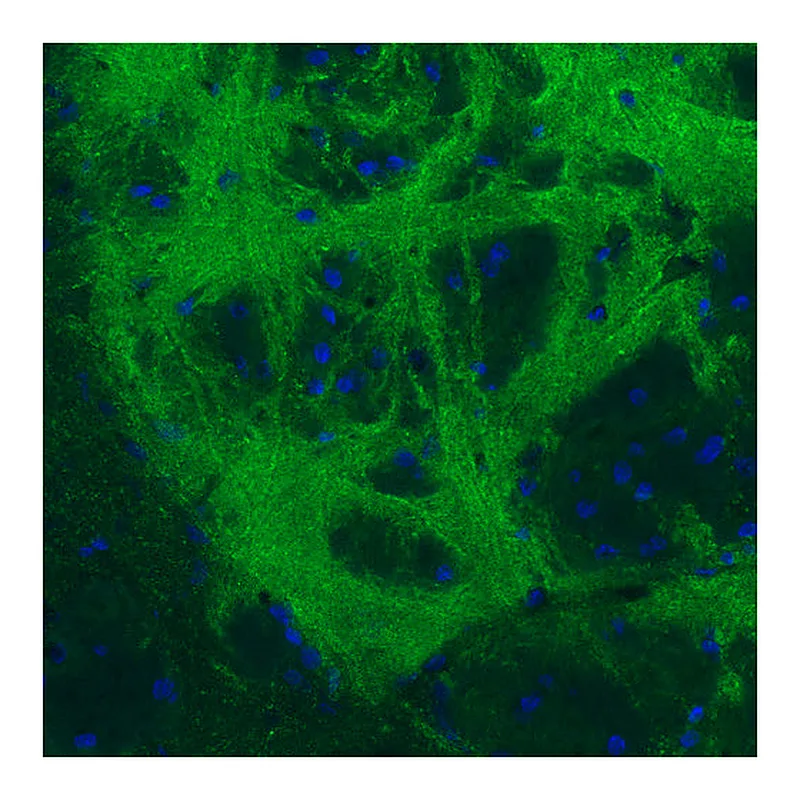 Atlas Antibodies Anti-GAD1 Antibody