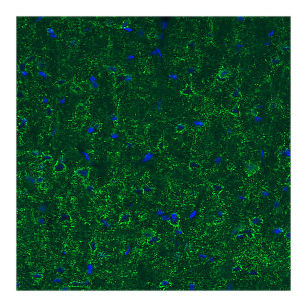 Atlas Antibodies Anti-GAD1 Antibody