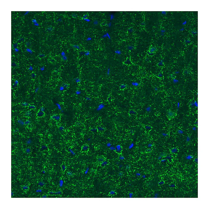 Atlas Antibodies Anti-GAD1 Antibody
