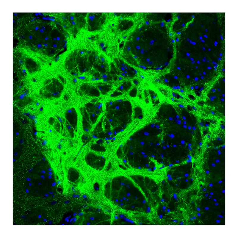 Atlas Antibodies Anti-GAD1 Antibody