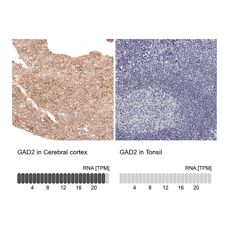 Atlas Antibodies Anti-GAD2 Antibody