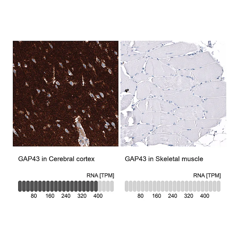 Atlas Antibodies Anti-GAP43 Antibody