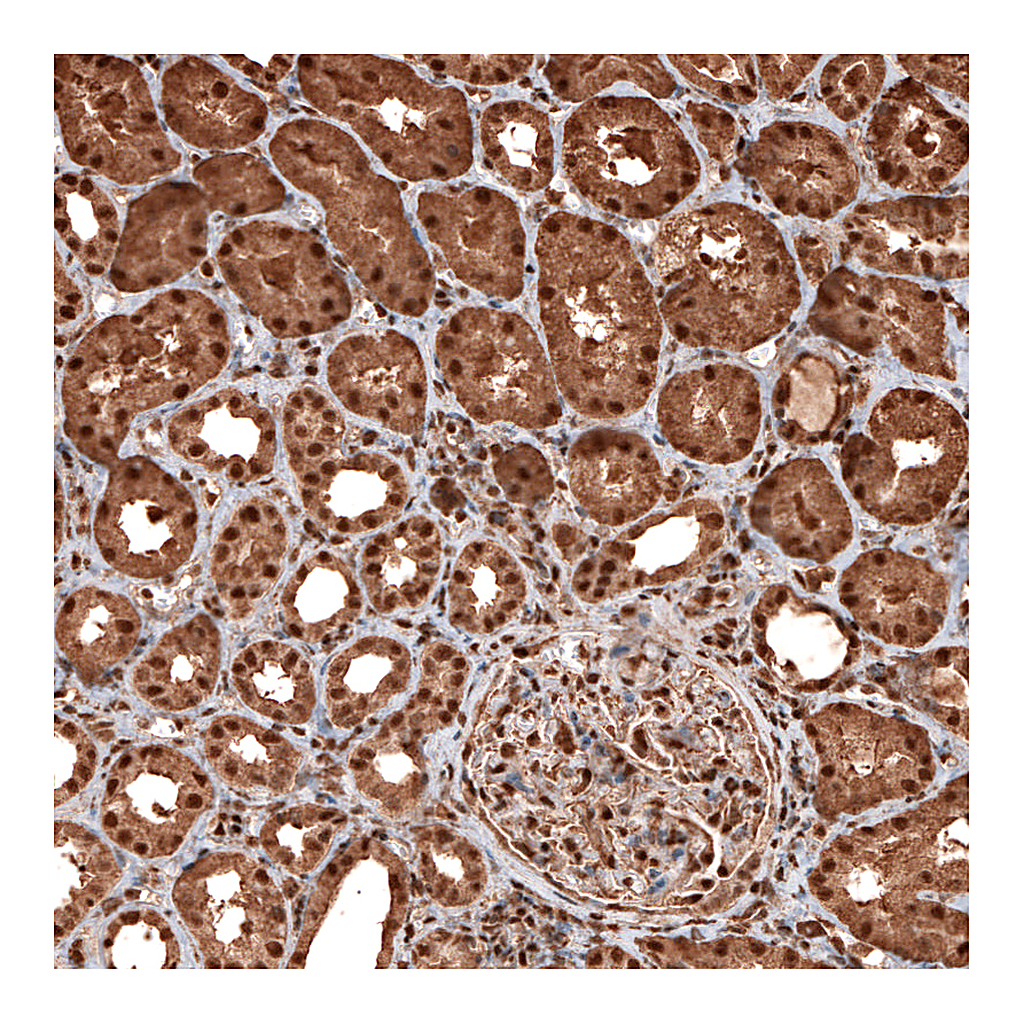 Atlas Antibodies Anti-GAPDH Antibody