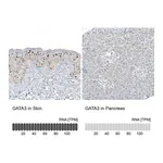 Atlas Antibodies Anti-GATA3 Antibody