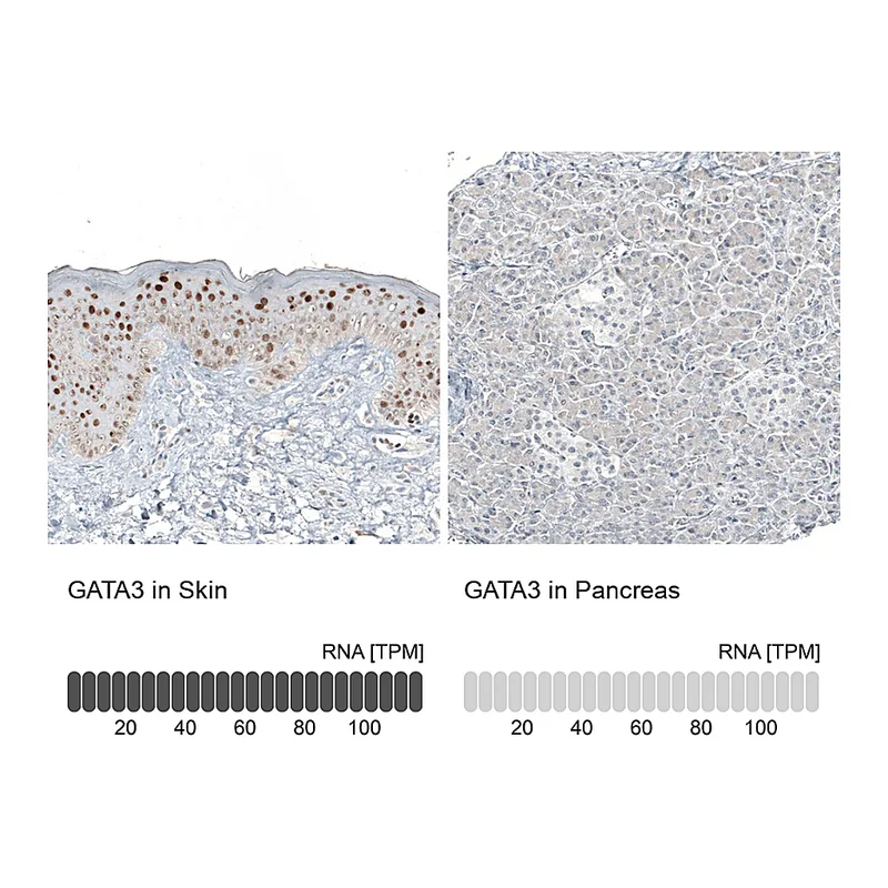 Atlas Antibodies Anti-GATA3 Antibody